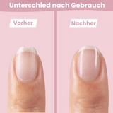 SafeCare – Geräuschlos & sicher – Elektrisches Baby-Nagelfeilen-Set